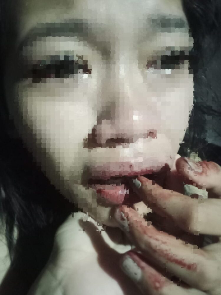 Pelaku Kekerasan terhadap Kekasih Diduga Ancam Keluarga Korban
